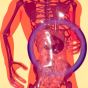Gut Microbiome Alert: Natural Food Preservative May Disrupt Healthy&nbsp;Bacteria
